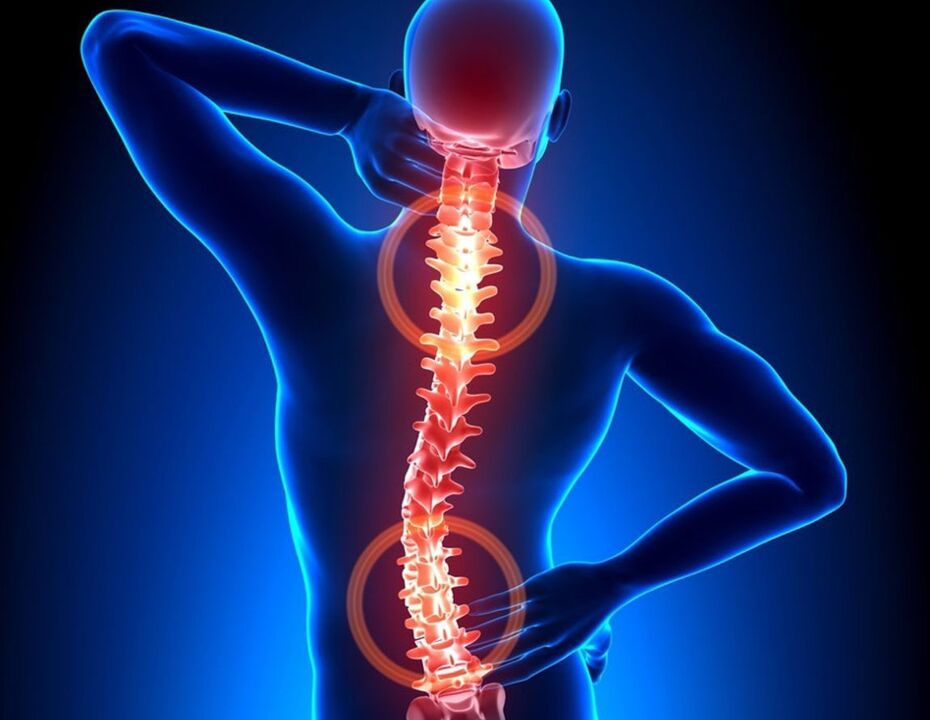 Osteocondritis of the spine