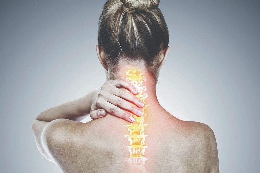 Cervical osteochondrosis