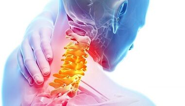 Causes of cervical osteochondrosis