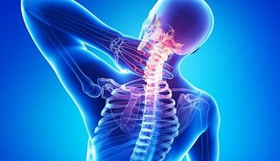 Complications of osteochondrosis of the cervical spine
