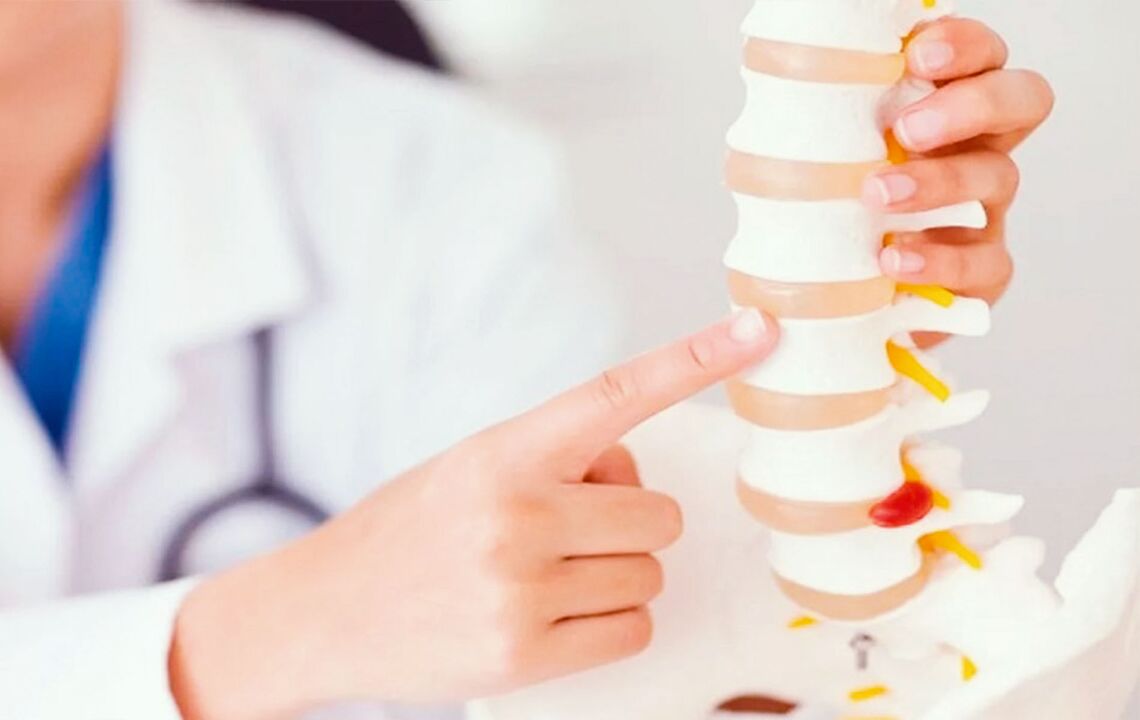 Damage to the spine caused by cervical osteochondrosis