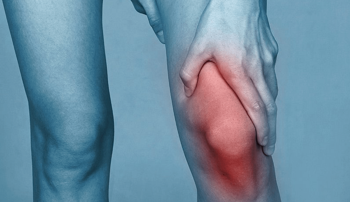 Pain in the knee joint due to osteoarthritis