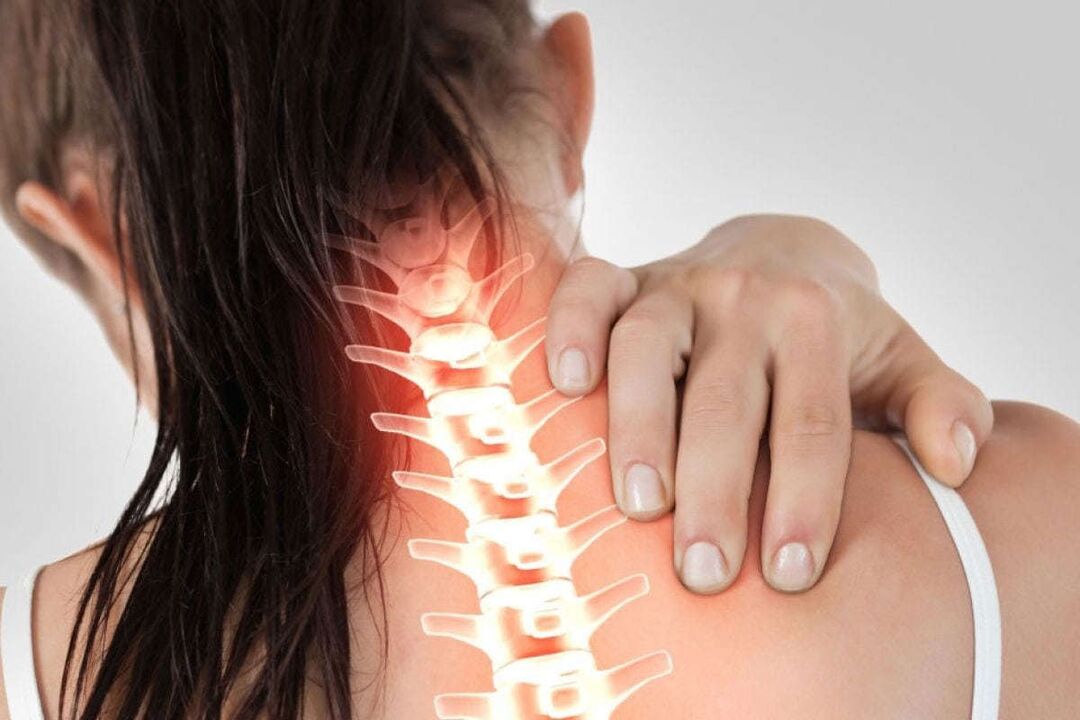 Manifestations of cervical osteochondrosis